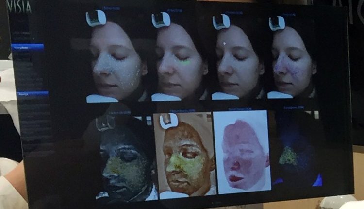 resultats diagnostic de peau ecran